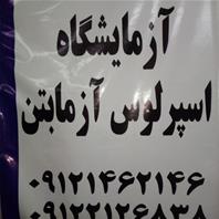 اسپرلوس آزمابتن